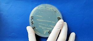 Escherichia Coli