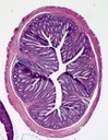 Fixation  and paraffin embedding of tissue samples