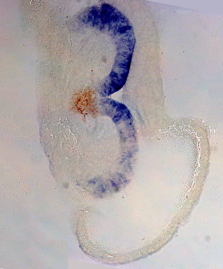 Gelatin embedding