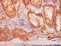 Immunohistochemistry on sections