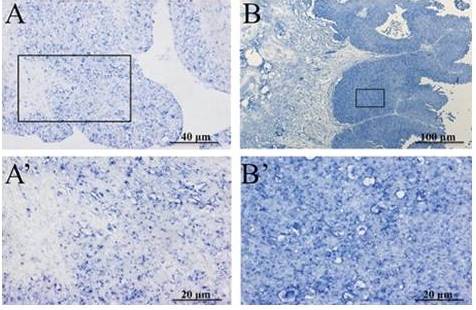 In Situ Hybridization  on sections