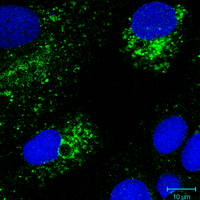 Autophagosomes staining with Anti-LC3B-II antibodies in epithelial  cells