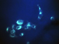 Labelling authophagosomes in live cells