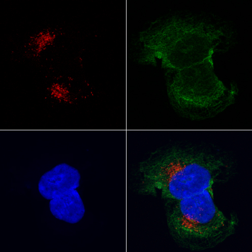 Labelling Lysosomes in live cells
