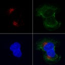 Labelling Lysosomes in live cells