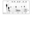 RNA-protein interaction